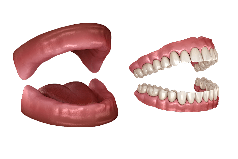 zubne-proteze